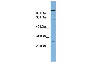 Image no. 1 for anti-CDNA Sequence BC051142 (BC051142) (Middle Region) antibody (ABIN2782735)
