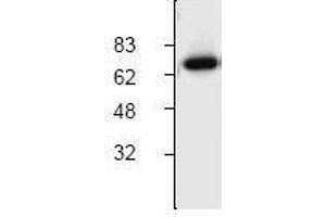 Image no. 1 for anti-Cholesteryl Ester Transfer Protein (CETP) (C-Term) antibody (ABIN127095)