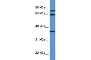 Image no. 1 for anti-Deoxyhypusine Synthase (DHPS) (AA 51-100) antibody (ABIN6746962)