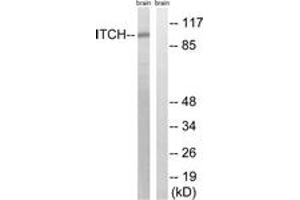 Image no. 1 for anti-Itchy E3 Ubiquitin Protein Ligase Homolog (ITCH) (AA 386-435) antibody (ABIN1533142)