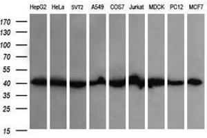 Image no. 8 for anti-Acetyl-CoA Acyltransferase 2 (ACAA2) antibody (ABIN1495726)