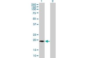 Image no. 1 for anti-Gremlin 2 (GREM2) (AA 1-168) antibody (ABIN528622)