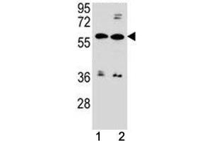 anti-ATP-Binding Cassette, Sub-Family G (WHITE), Member 4 (ABCG4) (AA 36-65) antibody