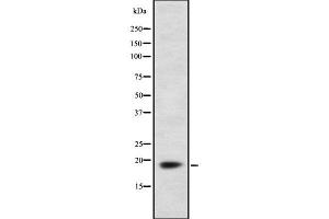 Image no. 2 for anti-Ferredoxin1 (FDX1) (Internal Region) antibody (ABIN6261708)