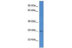 Image no. 1 for anti-SplA/ryanodine Receptor Domain and SOCS Box Containing 2 (SPSB2) (C-Term) antibody (ABIN926548)