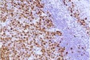 Image no. 3 for anti-Antigen Identified By Monoclonal Antibody Ki-67 (MKI67) (C-Term) antibody (ABIN6657412)