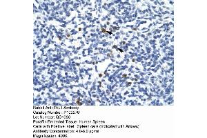 Image no. 2 for anti-T-Cell Acute Lymphocytic Leukemia 1 (TAL1) (Middle Region) antibody (ABIN2792682)