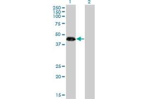 Image no. 2 for anti-Zinc Finger Protein 3 (ZNF3) (AA 1-110) antibody (ABIN521472)