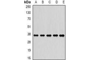 Image no. 3 for anti-Proteasome (Prosome, Macropain) 26S Subunit, Non-ATPase, 7 (PSMD7) (full length) antibody (ABIN6005118)