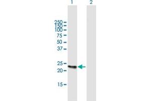 Image no. 1 for anti-Kallikrein 2 (KLK2) (AA 1-223) antibody (ABIN517349)