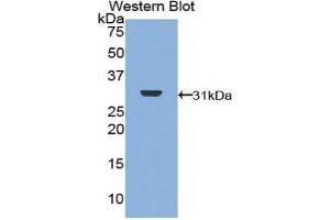 Image no. 1 for anti-DNA Topoisomerase II (TOP2) (AA 749-987) antibody (ABIN1860830)