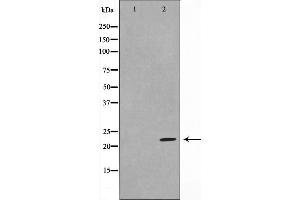 Image no. 1 for anti-DIRAS Family, GTP-Binding RAS-Like 1 (DIRAS1) antibody (ABIN6261302)
