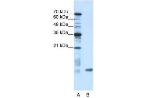 Image no. 1 for anti-SRA Stem-Loop Interacting RNA Binding Protein (SLIRP) (N-Term) antibody (ABIN633258)