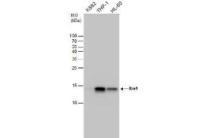 Image no. 3 for anti-Allograft Inflammatory Factor 1 (AIF1) (Center) antibody (ABIN2855067)