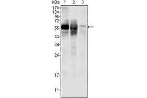 Image no. 3 for anti-Glucose-6-Phosphate Isomerase (GPI) antibody (ABIN1107377)