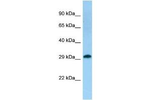 Image no. 1 for anti-Coiled-Coil Domain Containing 44 (CCDC44) (C-Term) antibody (ABIN2790869)