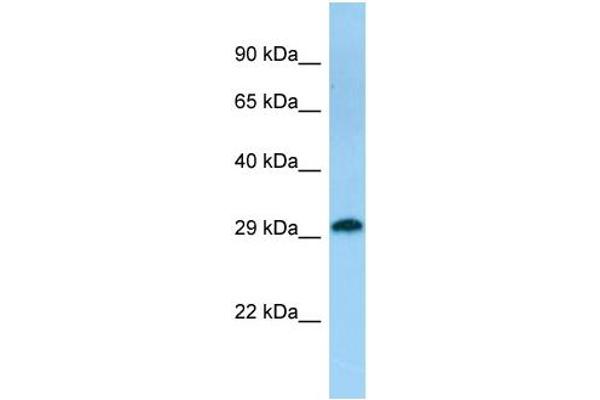 anti-Coiled-Coil Domain Containing 44 (CCDC44) (C-Term) antibody