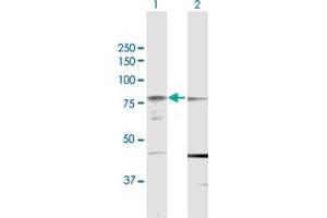Image no. 3 for anti-Protein Kinase C, eta (PRKCH) (AA 1-683) antibody (ABIN948317)