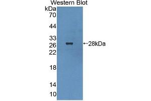 Image no. 2 for anti-Dystrobrevin Binding Protein 1 (DTNBP1) (AA 110-305) antibody (ABIN5013477)