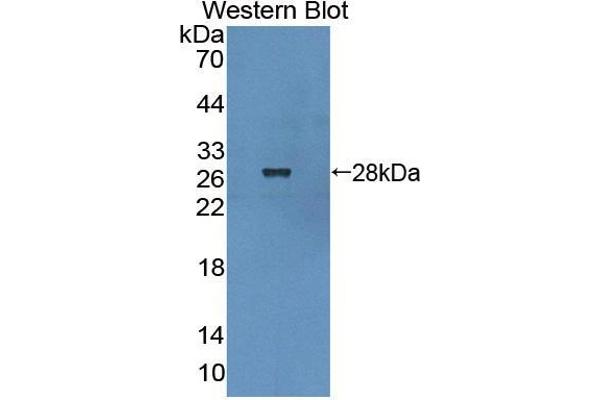 DTNBP1 antibody  (AA 110-305)