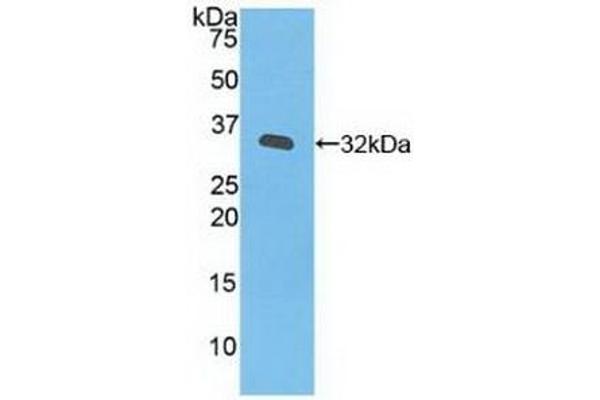 JAK3 Antikörper  (AA 716-967)