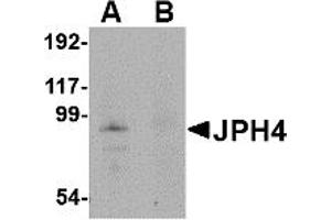 Image no. 1 for anti-Junctophilin 4 (JPH4) (Middle Region) antibody (ABIN1030971)
