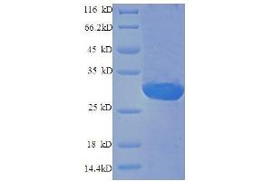 Endothelin 1 (EDN1) (AA 53-73) protein (GST tag)