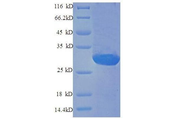 Endothelin 1 (EDN1) (AA 53-73) protein (GST tag)