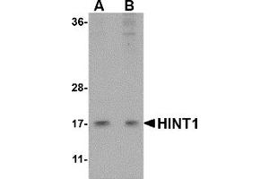 Western Blotting (WB) image for anti-Histidine Triad Nucleotide Binding Protein 1 (HINT1) (Middle Region) antibody (ABIN1030948)