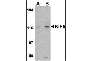 Image no. 1 for anti-Kinesin Family Member 5A (KIF5A) (Center) antibody (ABIN372915)