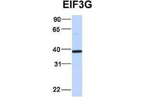 Image no. 3 for anti-Eukaryotic Translation Initiation Factor 3, Subunit G (EIF3G) (Middle Region) antibody (ABIN2778865)
