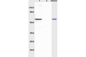 Image no. 2 for anti-Amyloid beta (A4) Precursor Protein-Binding, Family A, Member 3 (APBA3) (AA 241-340) antibody (ABIN1385696)