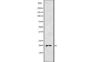 Image no. 1 for anti-Dual Specificity Phosphatase 3 (DUSP3) (N-Term) antibody (ABIN6261383)