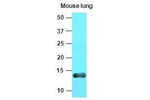 Image no. 1 for anti-Vesicle-Associated Membrane Protein 3 (VAMP3) (AA 1-77), (N-Term) antibody (ABIN336092)