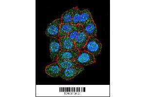 Immunofluorescence (IF) image for anti-Additional Sex Combs Like 1 (ASXL1) (Center) antibody (ABIN2159311)