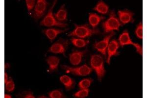 Image no. 2 for anti-Aminolevulinate, delta-, Synthase 1 (ALAS1) (Internal Region) antibody (ABIN6259873)
