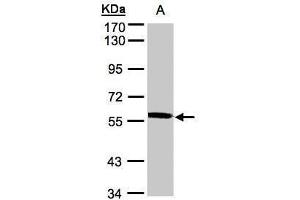 Image no. 1 for anti-X-Prolyl Aminopeptidase (Aminopeptidase P) 3, Putative (XPNPEP3) (Center) antibody (ABIN2856118)