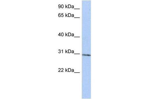 anti-tRNA Methyltransferase 61 Homolog A (TRMT61A) (N-Term) antibody