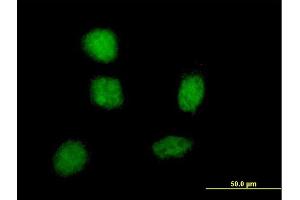 Immunofluorescence of monoclonal antibody to SOX21 on HeLa cell.