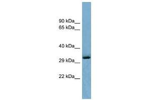 Image no. 1 for anti-OTU Domain Containing 6B (OTUD6B) (Middle Region) antibody (ABIN634385)