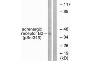 Western blot analysis of extracts from HepG2 cells treated with nocodazole 1ug/ml 16h, using Adrenergic Receptor beta2 (Phospho-Ser346) Antibody.