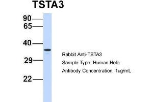 Image no. 2 for anti-Tissue Specific Transplantation Antigen P35B (TSTA3) (N-Term) antibody (ABIN2787788)
