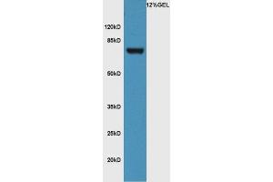Image no. 3 for anti-Frizzled Family Receptor 3 (FZD3) (AA 121-220) antibody (ABIN1714171)