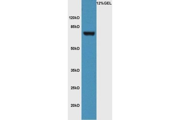 FZD3 antibody  (AA 121-220)