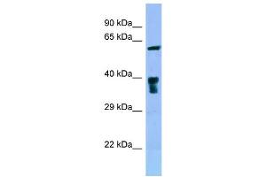Image no. 1 for anti-Solute Carrier Family 22 Member 5 (SLC22A5) (C-Term) antibody (ABIN2789487)
