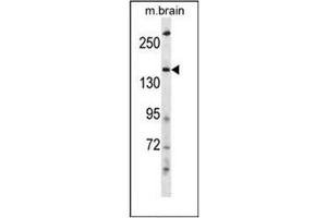 Image no. 1 for anti-HECT, C2 and WW Domain Containing E3 Ubiquitin Protein Ligase 2 (HECW2) (AA 847-876), (Middle Region) antibody (ABIN953642)
