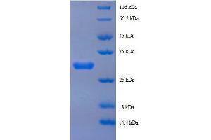Image no. 1 for Peptide YY (PYY) (AA 31-64), (full length) protein (GST tag) (ABIN1047502)