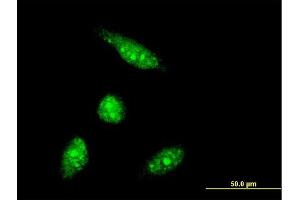 Image no. 1 for anti-PHD Finger Protein 5A (PHF5A) (AA 1-110) antibody (ABIN2565767)