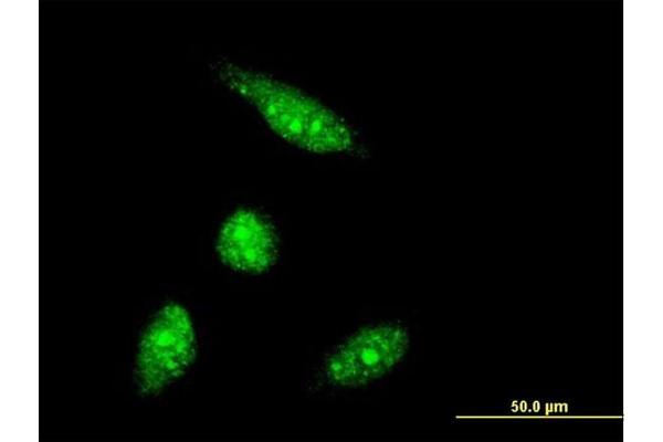 anti-PHD Finger Protein 5A (PHF5A) (AA 1-110) antibody