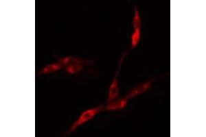 Image no. 1 for anti-Eukaryotic Translation Initiation Factor 3 Subunit F (EIF3F) antibody (ABIN6257159)
